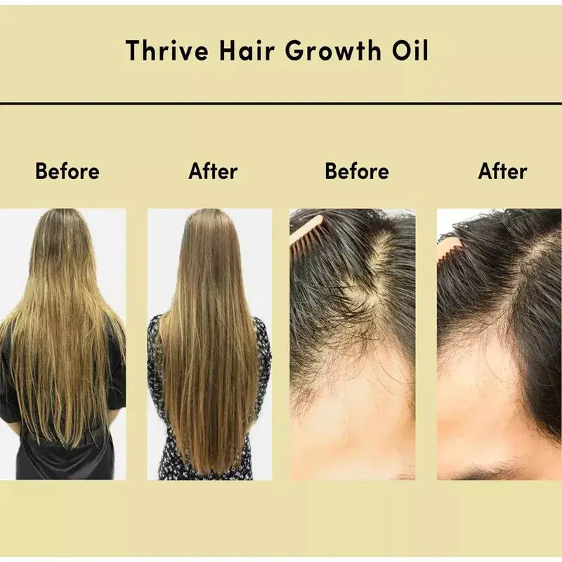 Thrive Hair Growth Aceite esencial para el cabello